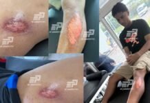 ¡Imágenes exclusivas! Así quedaron las piernas de jugadores del Olimpia tras jugar en la cuestionada cancha de La Paz